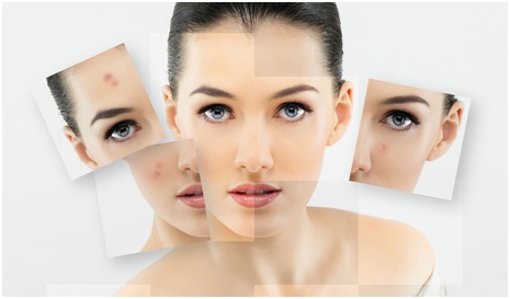 Best Chemical Peel Treatment Udaipur