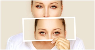 Eyelid Surgery in Udaipur