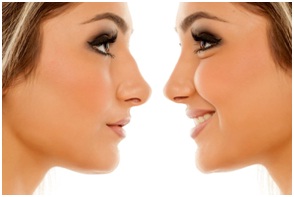 Non Surgical Facial Contouring in Udaipur